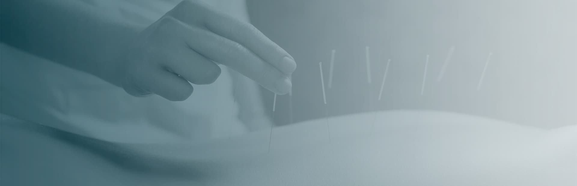 Acupuntura Termoguiada