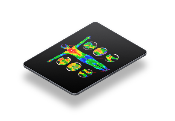 Termografia Computadorizada